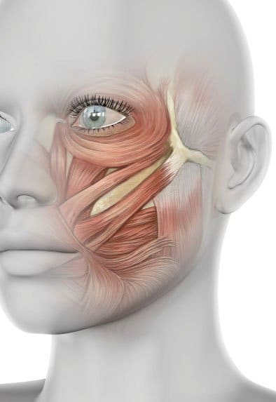 Parálisis Facial